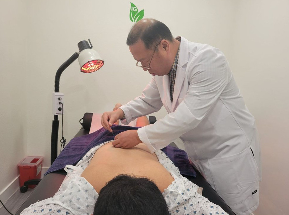 acupuncture in irvine CA